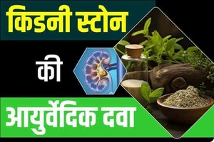 किडनी पथरी निकालने की आयुर्वेदिक दवा