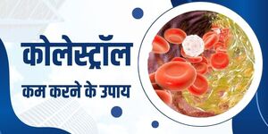 कोलेस्ट्रॉल कम करने के प्राकृतिक उपाय